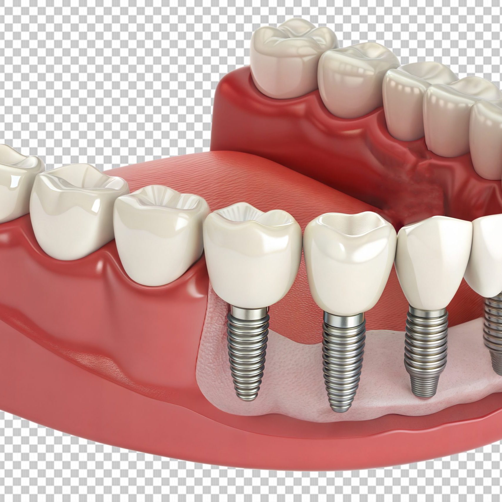 57515562-6399-4fb3-a6c9-29c10ab44d39